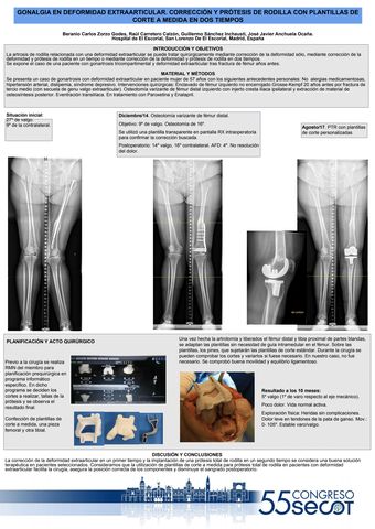 Comportamiento de la infección periprotésica de rodilla