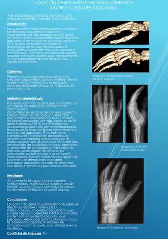 Tendinitis de Quervain - Juan Arnal: Traumatologo en Madrid