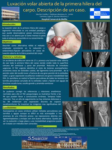 Cirugía de Rodilla por Artrosis - Dr. J. Galindo Contreras