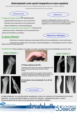 Tendinitis de Quervain - Juan Arnal: Traumatologo en Madrid