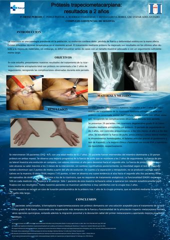 Tendinitis de Quervain - Juan Arnal: Traumatologo en Madrid